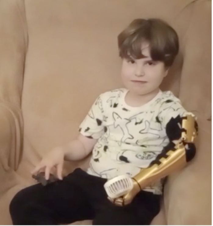 A. with the Kinetic Arm, ongoing use