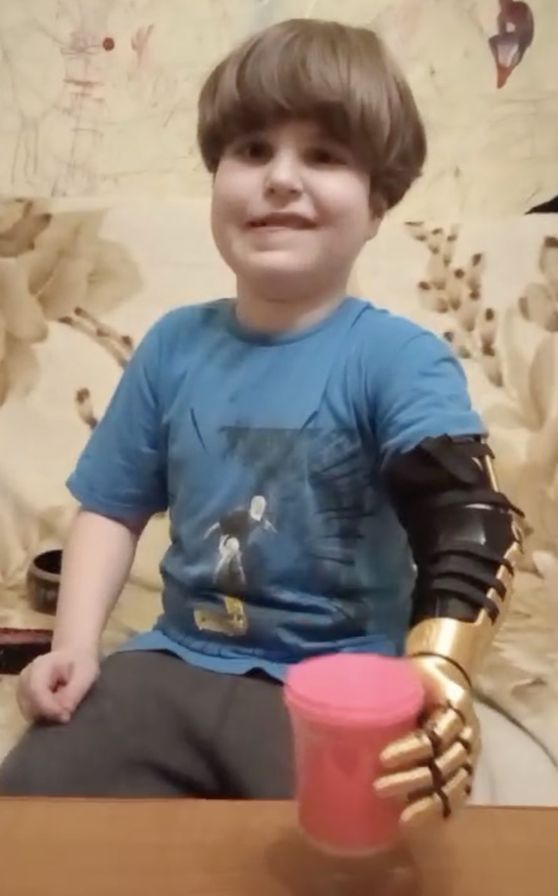 A. smiling as he grips a pink cup with his new gold arm. January 8, 2025