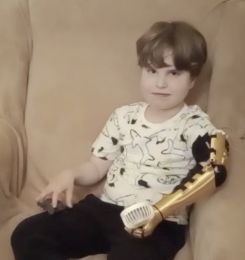 A. relaxed with the arm on his left side