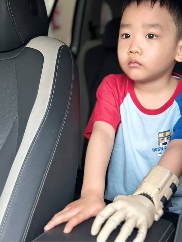 W. in the car, prosthetic hand resting on the seat, looking out the window