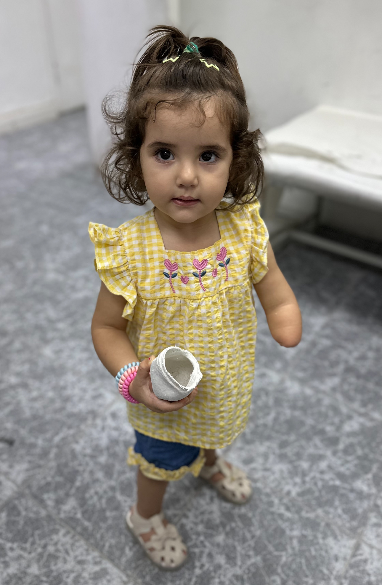S. in her yellow gingham dress, holding a plaster cast of her arm at Pal Orthopedics