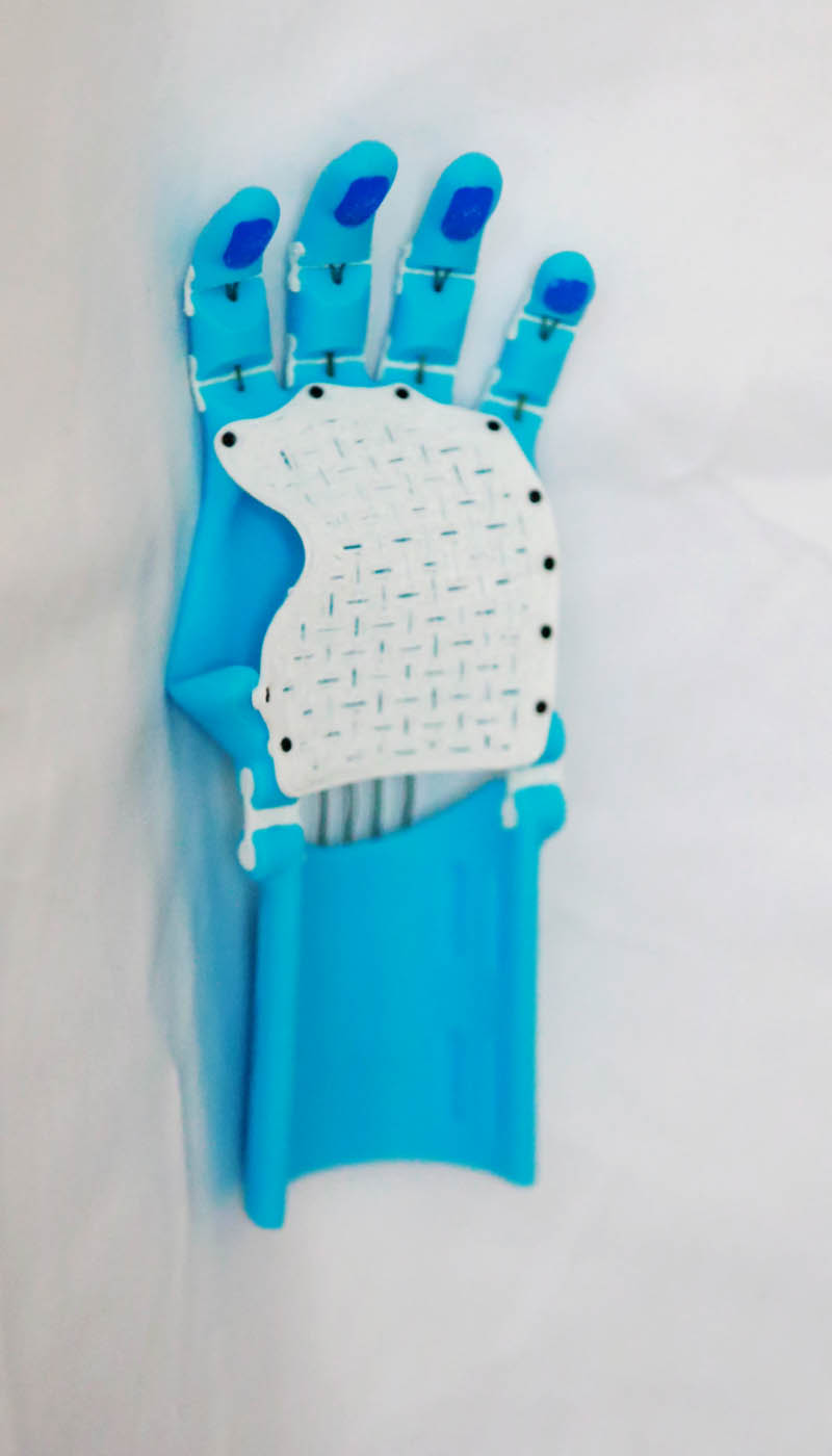 The light blue Thumbless Kinetic Hand lying palm-side up on white fabric, showing the white lattice palm plate, the blue finger joints with blue fingertip accents, and the tension cords running through the assembly