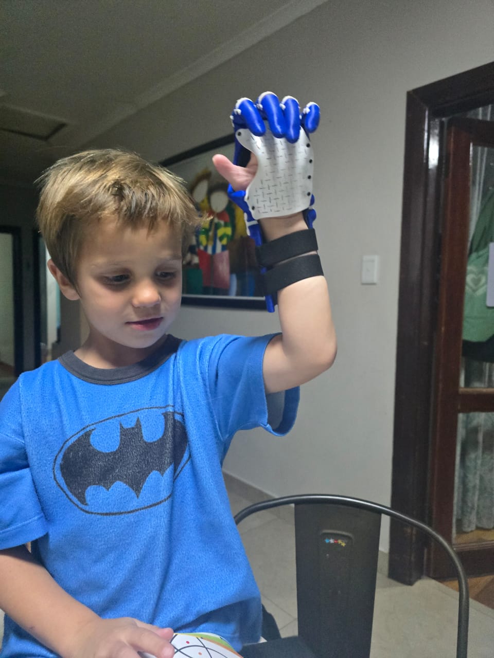 Noah raising his left hand with the dark blue prosthetic hand fitted over it, looking at the fingers with quiet curiosity