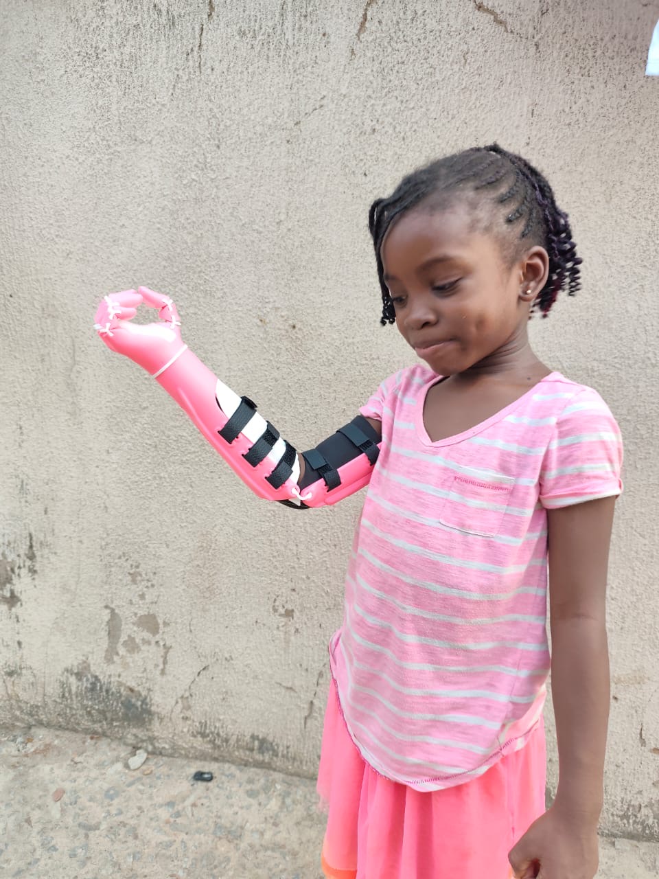 O.C. looking down at her pink prosthetic arm, examining how it works