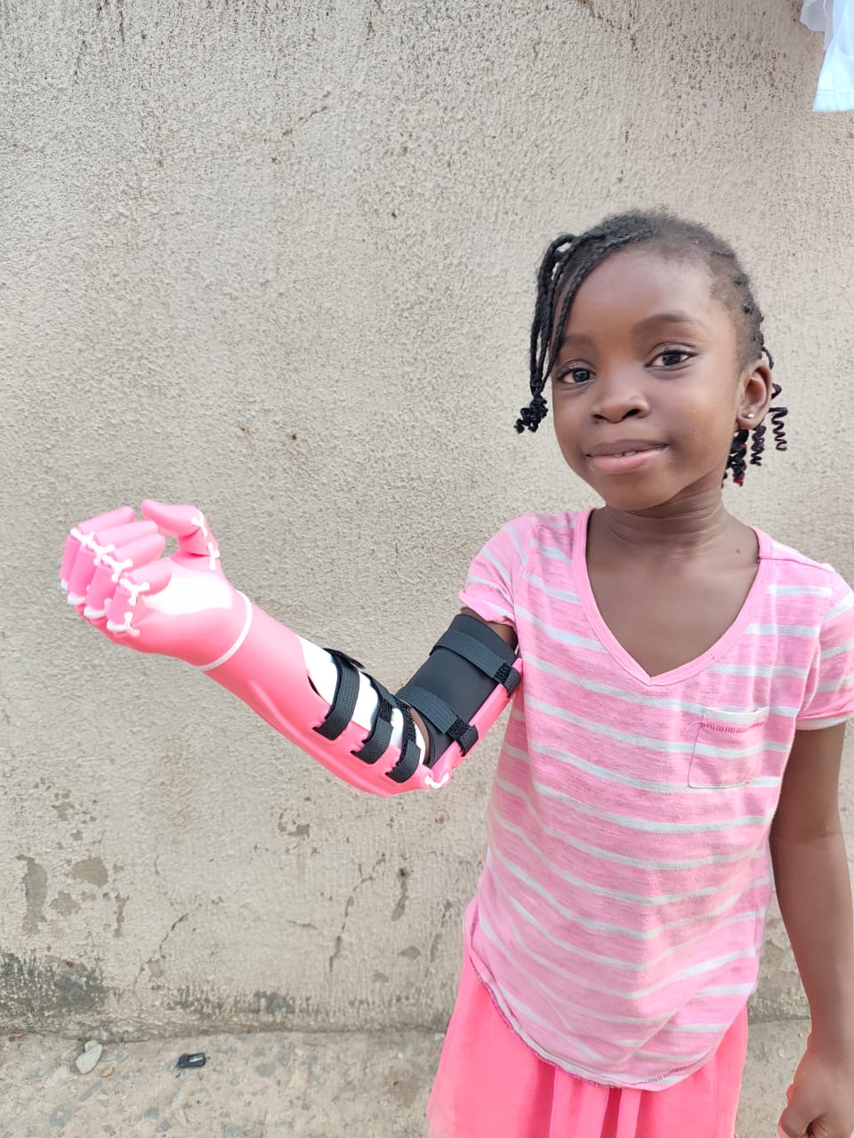 O.C. holding up her pink prosthetic arm toward the camera, smiling, wearing a pink striped shirt