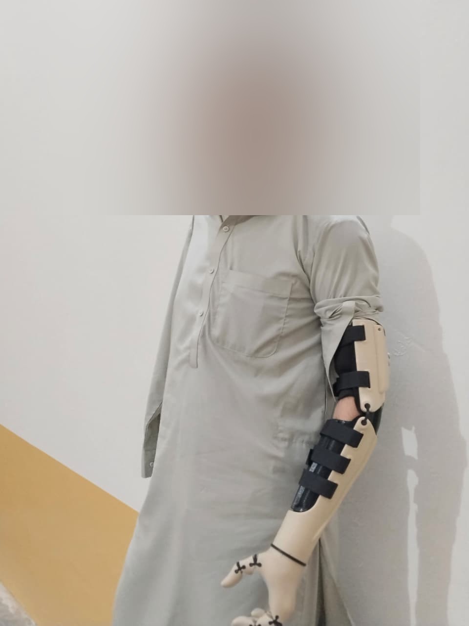 A.S. wearing the skin-tone Kinetic Arm, standing, Lower Dir, Pakistan