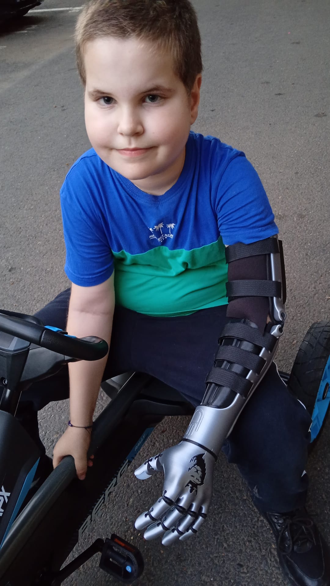 A. from Bucharest, Romania, wearing his silver Kinetic Arm with a crowned lion design